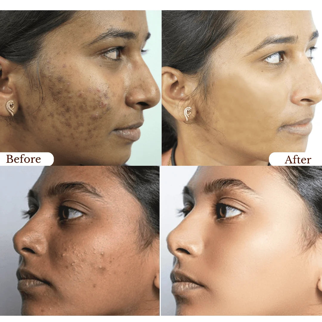 Orange Exfoliating Gel for Face & Body